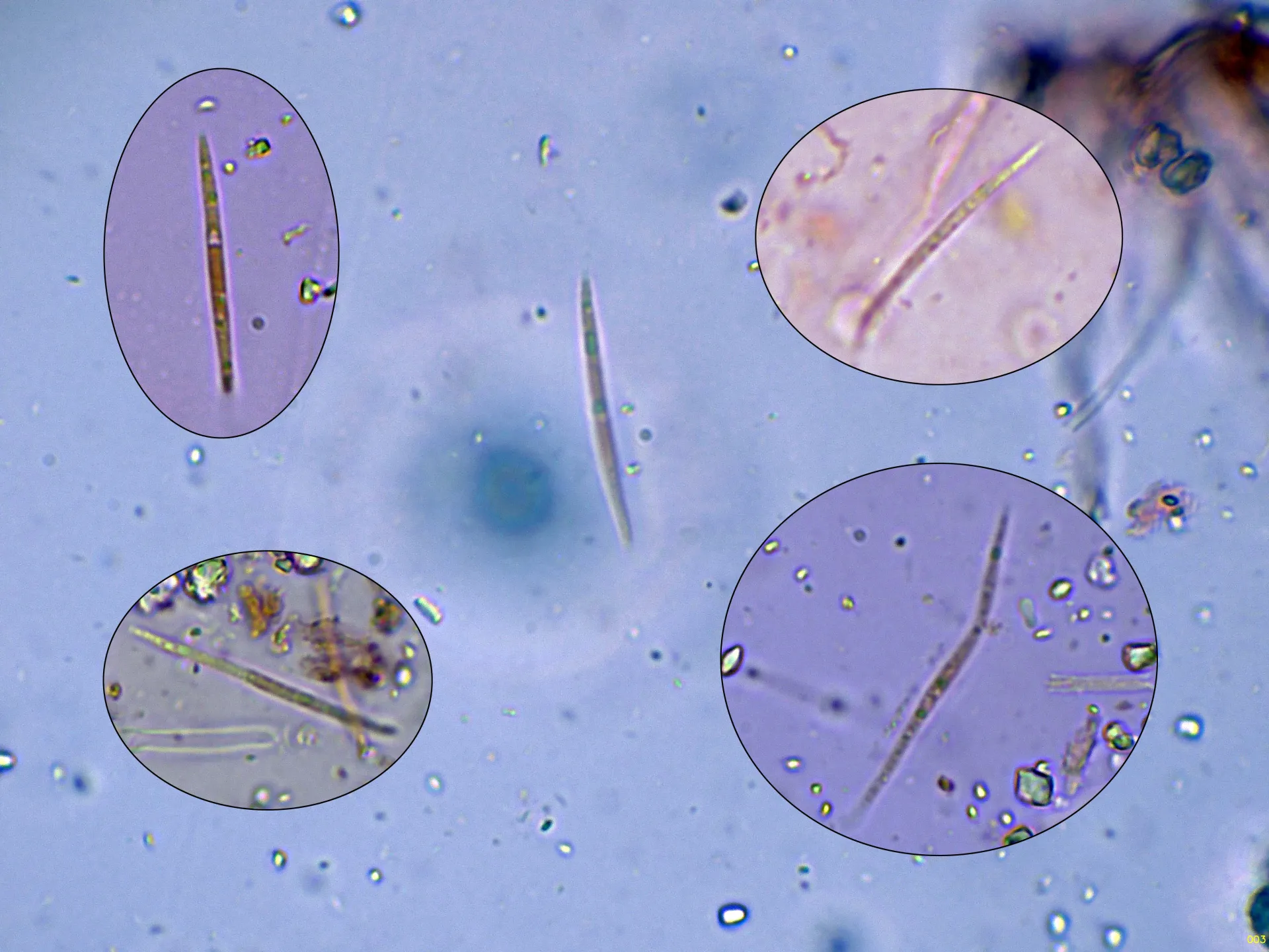 Microscopía de Lophodermium gramineum - 10 - Esporas libres